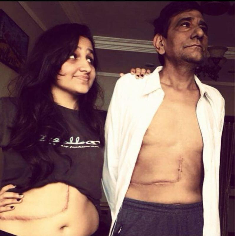 Pooja Bijarnia, Donate Her Liver, Save Her Father