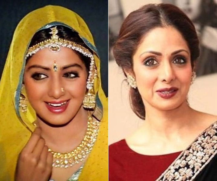 Lip Surgery, Bollywood Actresses went wrong