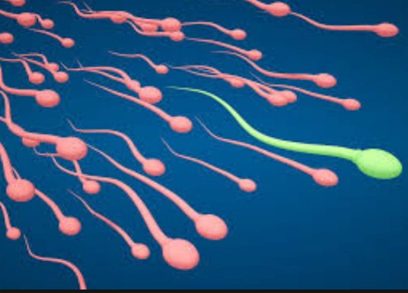 Male Infertility