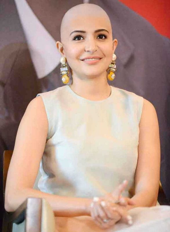 Anushka Sharma bald look